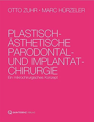 Plastisch sthetische Parodontal und Implantatchirurgie Ein mikrochirurgisches Konzept 0